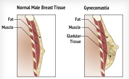 Side effects of steroids for males